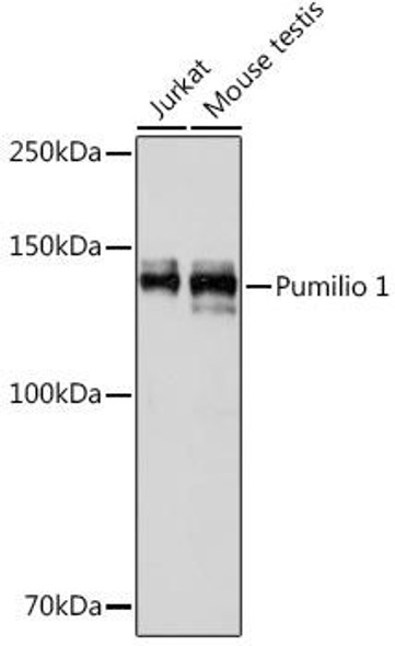 Anti-Pumilio 1 Antibody (CAB0571)