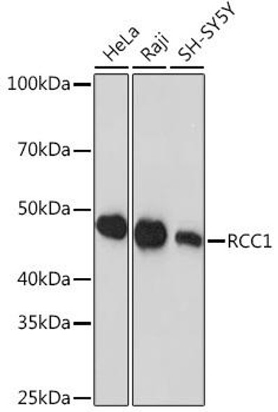 Anti-RCC1 Antibody (CAB0662)