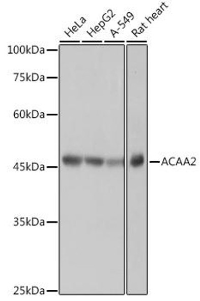 Anti-ACAA2 Antibody (CAB0664)
