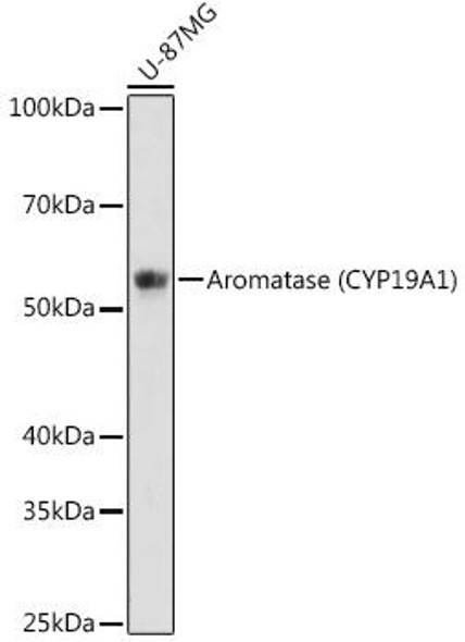 Anti-Aromatase (CYP19A1) Antibody (CAB12238)