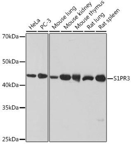 Anti-S1PR3 Antibody (CAB1404)