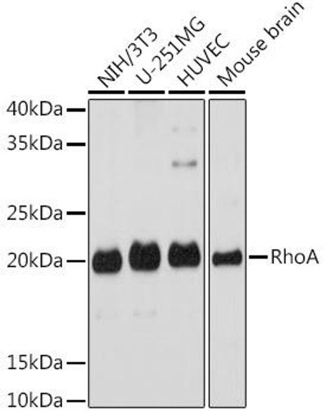 Anti-RhoA [KO Validated] Antibody (CAB18695)