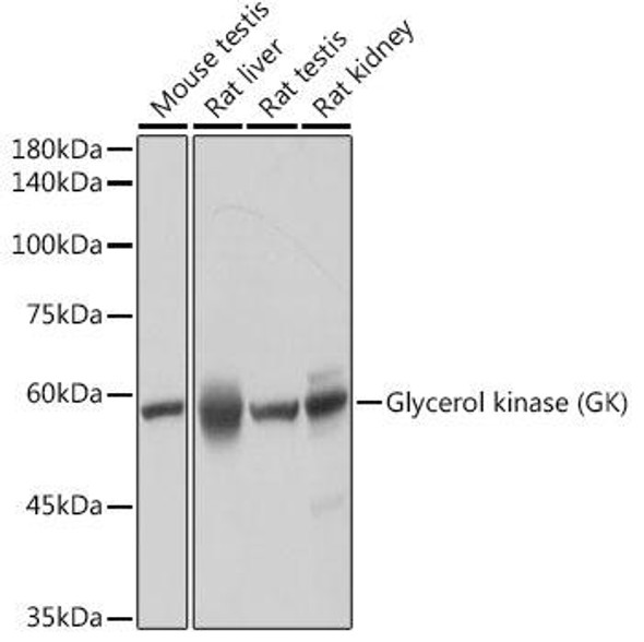 Anti-Glycerol kinase (GK) Antibody (CAB19221)