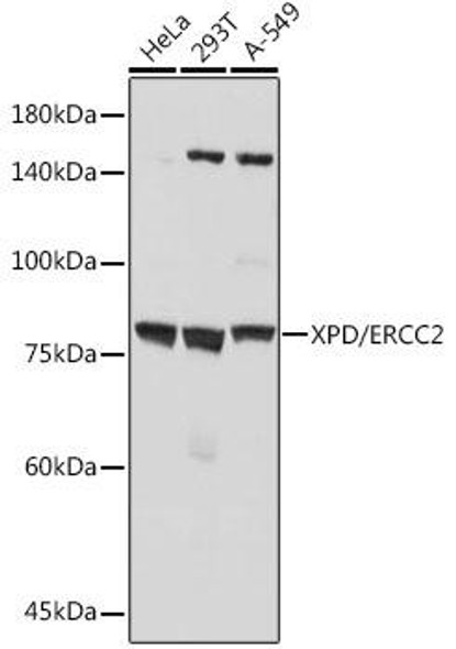 Anti-XPD/ERCC2 Antibody (CAB19241)