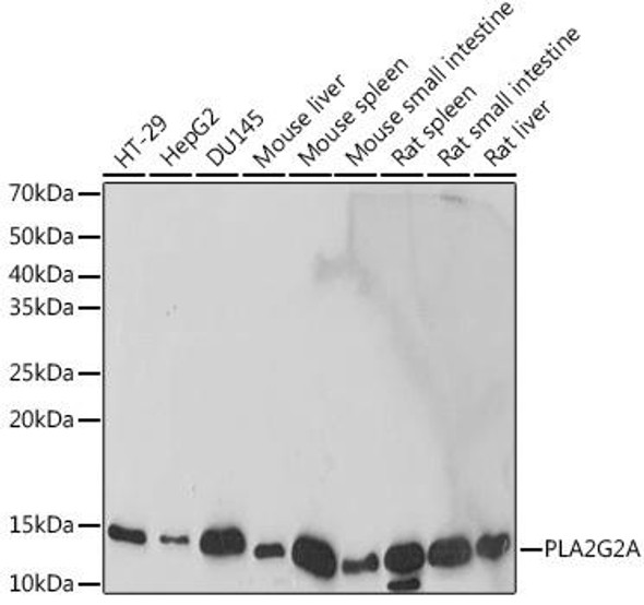 Anti-PLA2G2A Antibody (CAB19252)