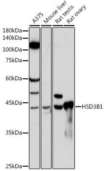 Anti-HSD3B1 Antibody (CAB19266)
