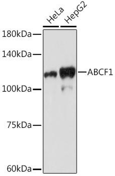 Anti-ABCF1 Antibody (CAB19621)