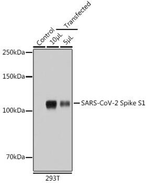Anti-SARS-CoV-2 Spike S1 Antibody (CAB20136)