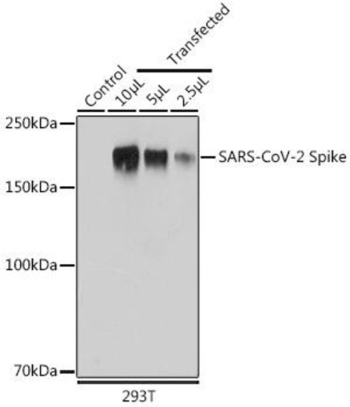 Anti-SARS-CoV-2 Spike Antibody (CAB20137)