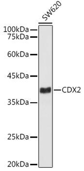 Anti-CDX2 Antibody (CAB20222)