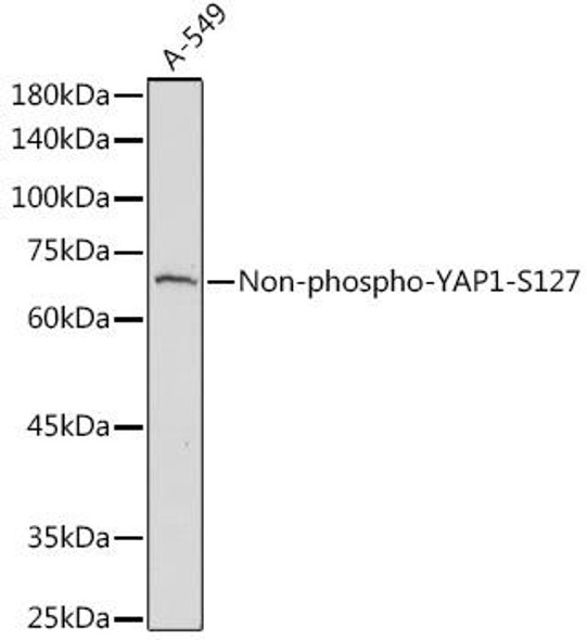 Anti-Non-phospho-YAP1-S127 Antibody (CAB20250)