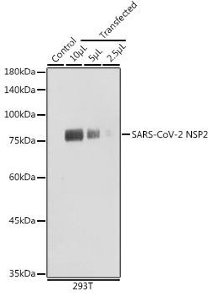 Anti-SARS-CoV-2 NSP2 Antibody (CAB20280)