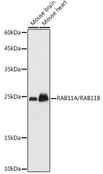 Anti-RAB11A/RAB11B Antibody (CAB20286)
