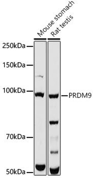Anti-PRDM9 Antibody (CAB20340)