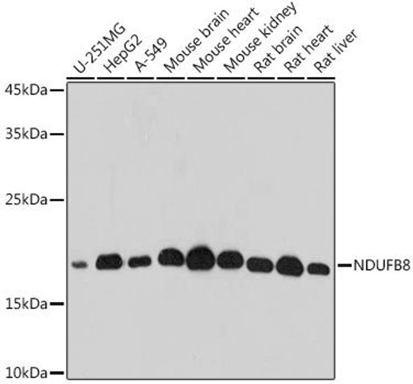 Anti-NDUFB8 Antibody (CAB20457)