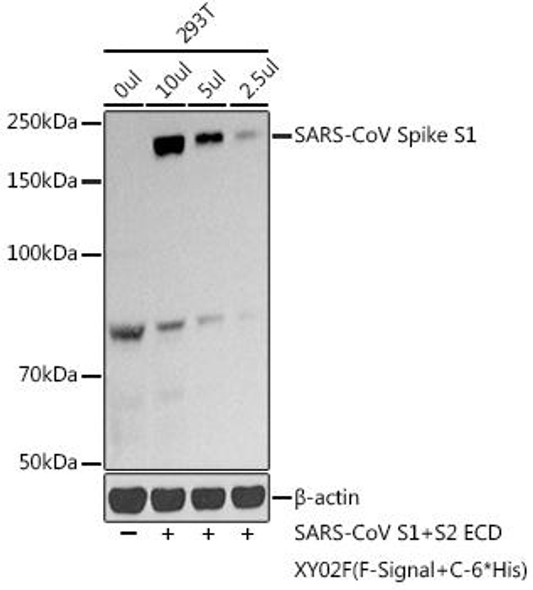 Anti-SARS-CoV Spike S1 Antibody (CAB20604)