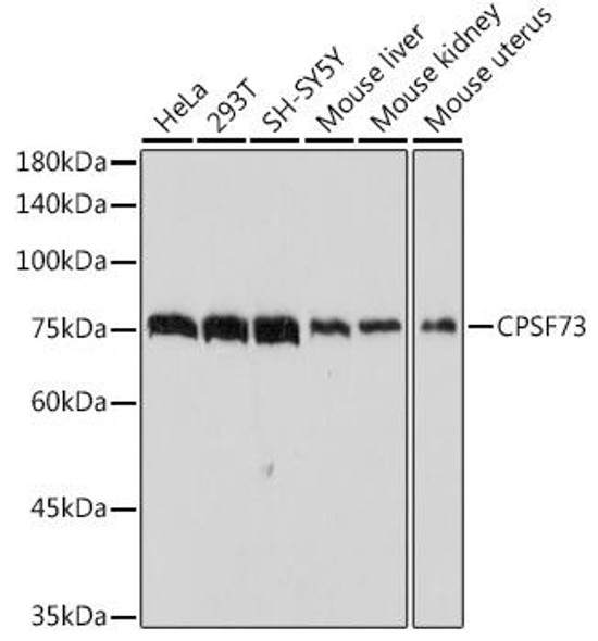 Anti-CPSF73 Antibody (CAB2222)