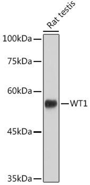 Anti-WT1 Antibody (CAB2446)