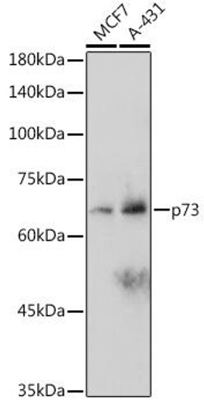 Anti-p73 Antibody (CAB2670)