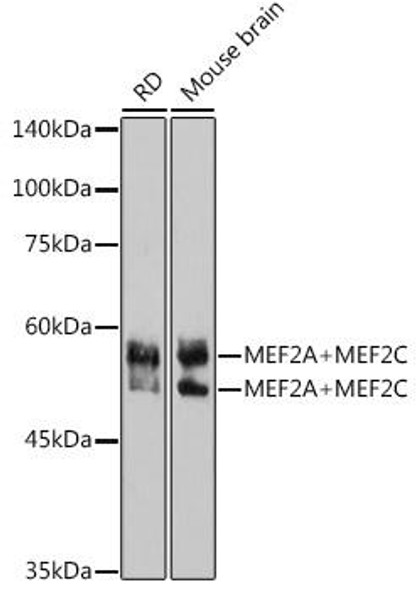 Anti-MEF2A+MEF2C Antibody (CAB2710)