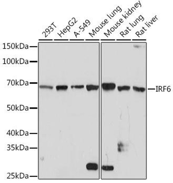 Anti-IRF6 Antibody (CAB3209)