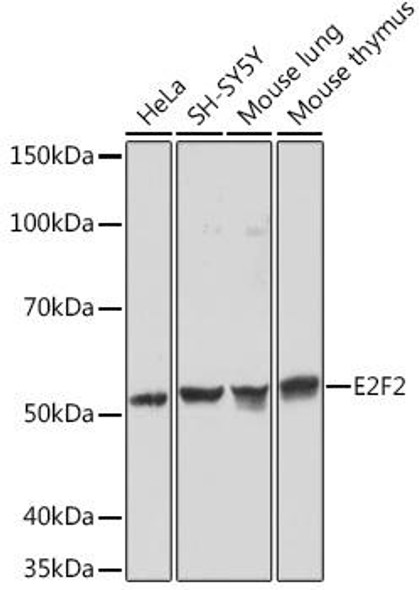Anti-E2F2 Antibody (CAB3297)