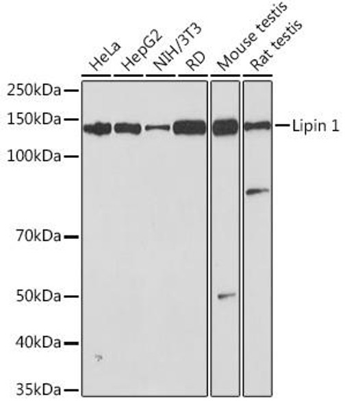 Anti-Lipin 1 Antibody (CAB3326)