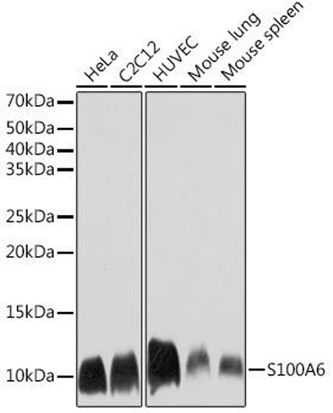 Anti-S100A6 Antibody (CAB3461)