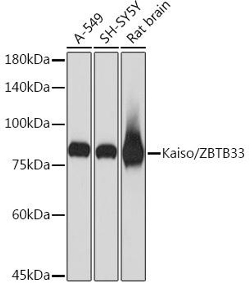 Anti-Kaiso/ZBTB33 Antibody (CAB3770)
