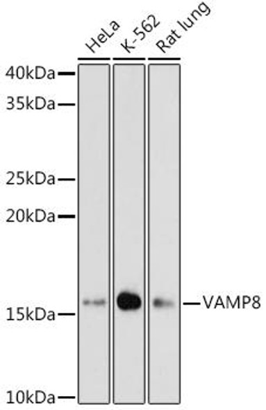 Anti-VAMP8 Antibody (CAB4728)