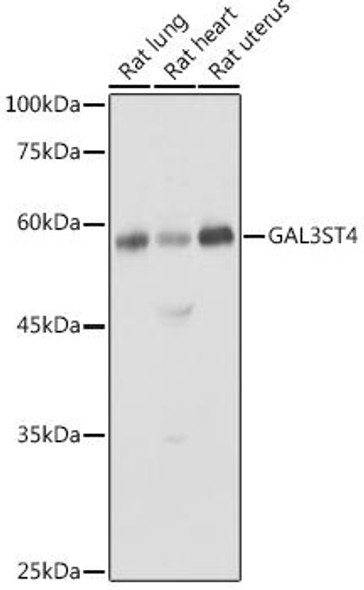 Anti-GAL3ST4 Antibody (CAB4979)
