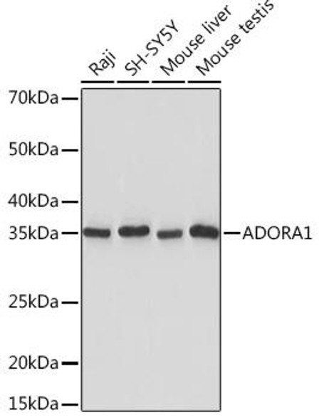 Anti-ADORA1 Antibody (CAB5219)