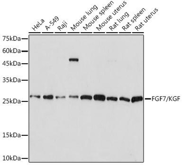 Anti-FGF7/KGF Antibody (CAB5966)