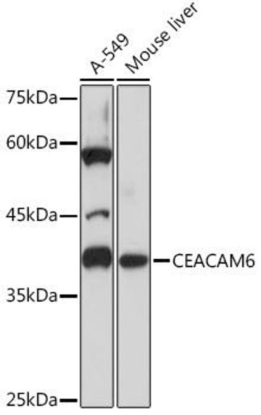 Anti-CEACAM6 Antibody (CAB5971)