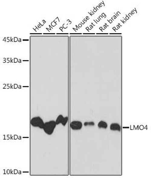 Anti-LMO4 Antibody (CAB5999)