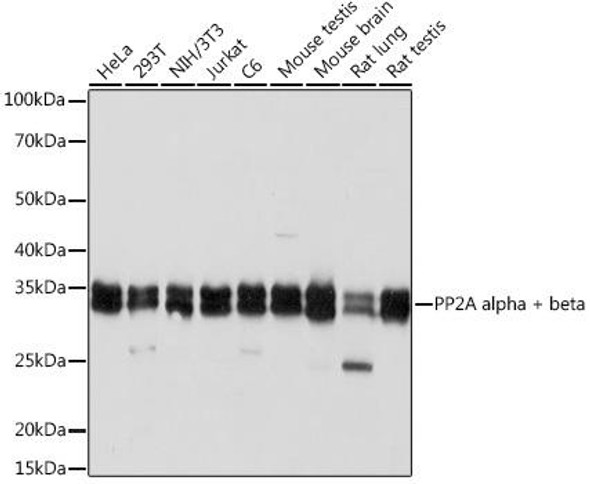 Anti-PP2A alpha + beta Antibody (CAB6175)