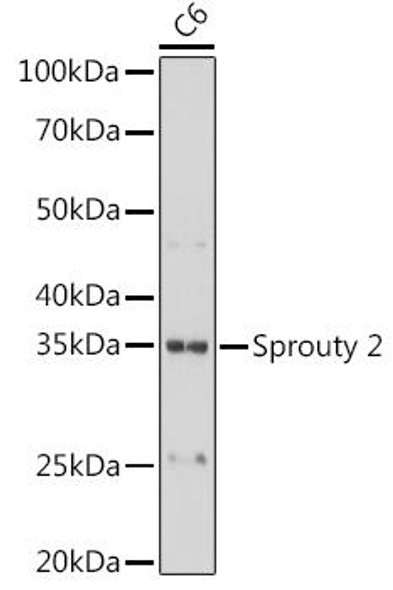 Anti-Sprouty 2 Antibody (CAB8611)