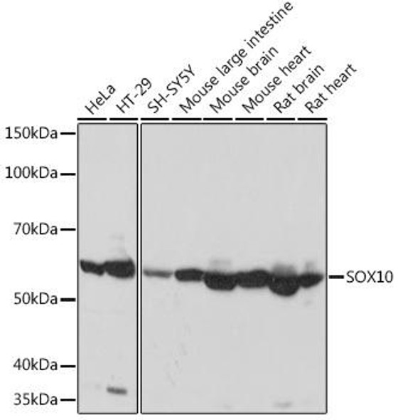 Anti-SOX10 Antibody (CAB8655)