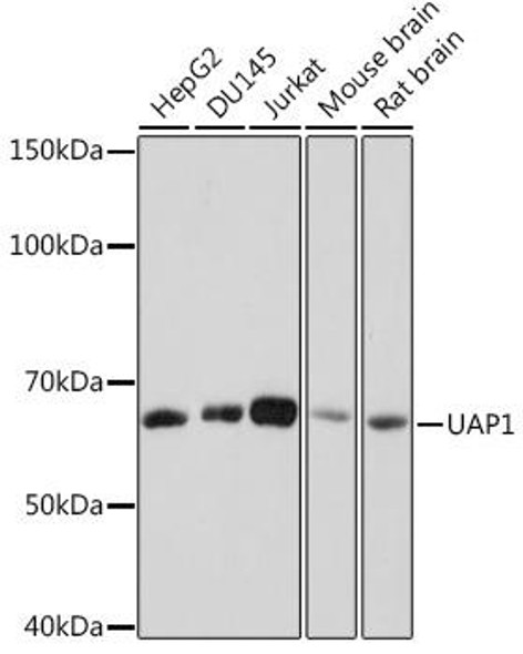 Anti-UAP1 Antibody (CAB8662)
