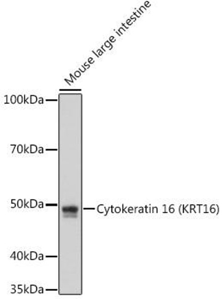 Anti-Cytokeratin 16 (KRT16) Antibody (CAB8690)