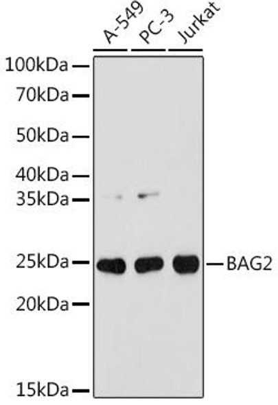 Anti-BAG2 Antibody (CAB8775)
