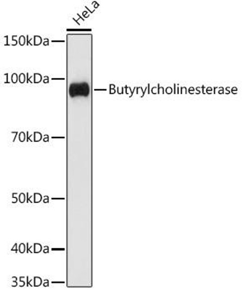 Anti-Butyrylcholinesterase Antibody (CAB8861)