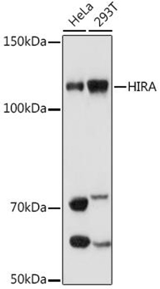 Anti-HIRA Antibody (CAB8892)