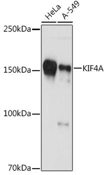Anti-KIF4A Antibody (CAB9080)