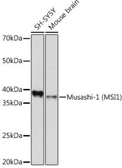 Anti-Musashi-1 (MSI1) Antibody (CAB9122)