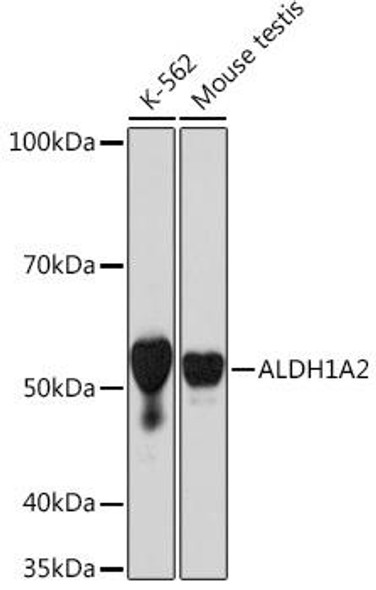 Anti-ALDH1A2 Antibody (CAB9123)