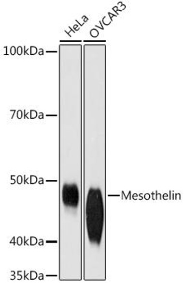 Anti-Mesothelin Antibody (CAB9180)