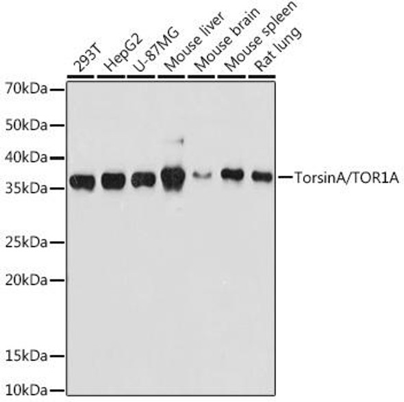 Anti-TorsinA/TOR1A Antibody (CAB9579)