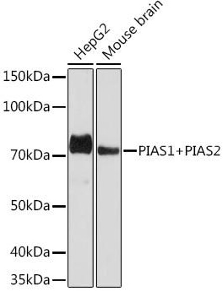 Anti-PIAS1+PIAS2 Antibody (CAB9670)
