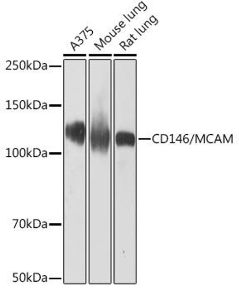 Anti-CD146/MCAM Antibody (CAB9703)